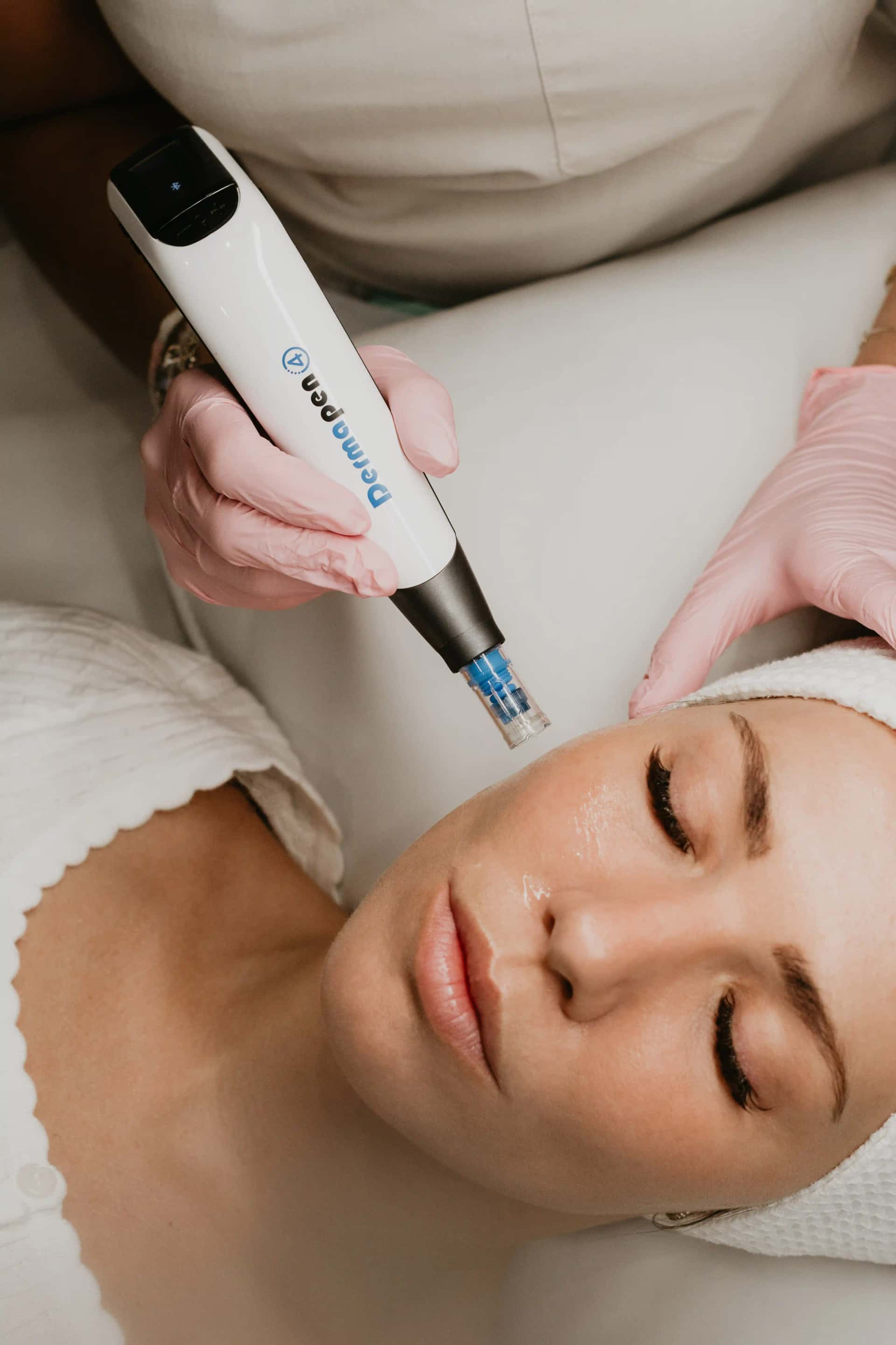 Microneedling DP4