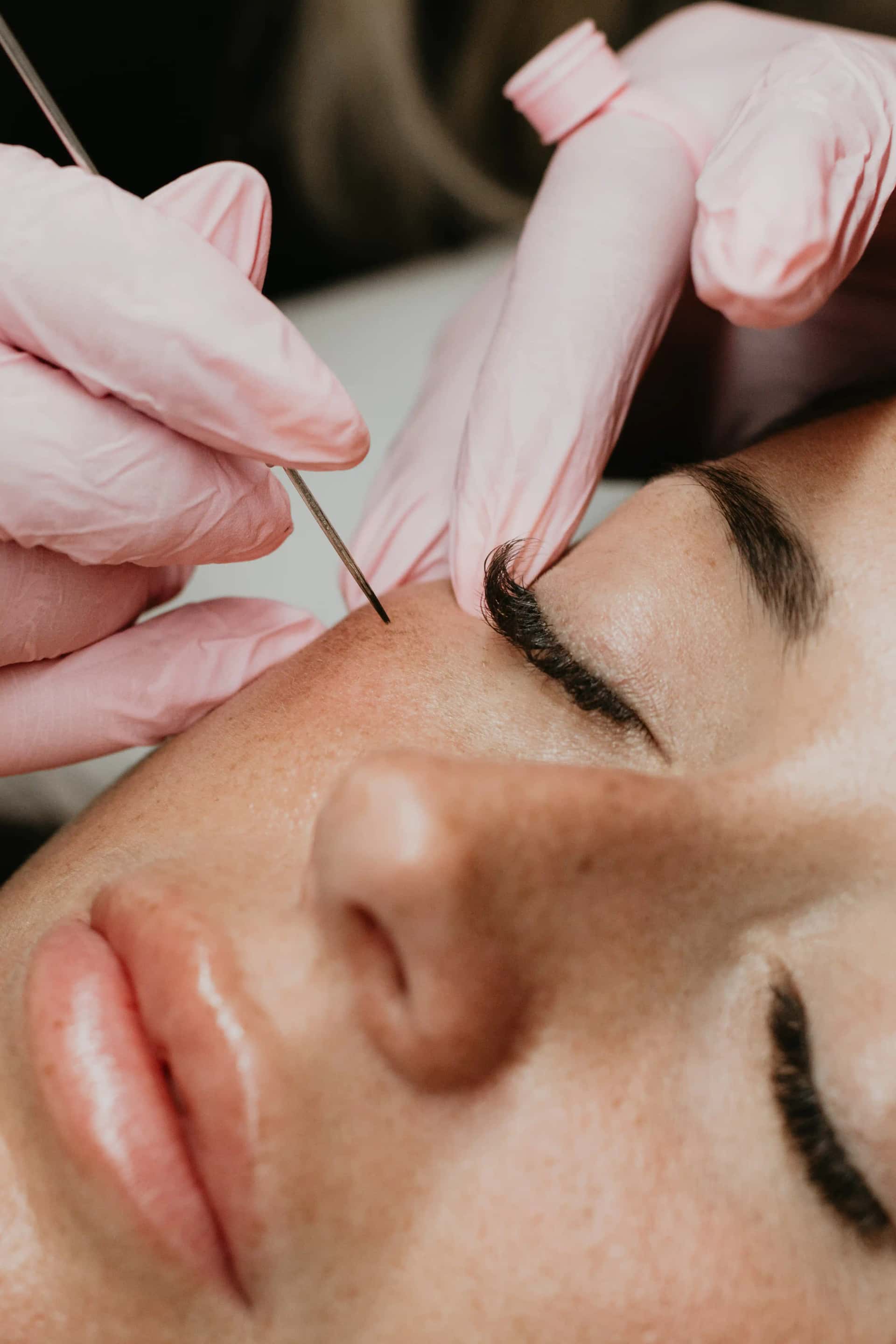 Freckles (Taches de rousseur)