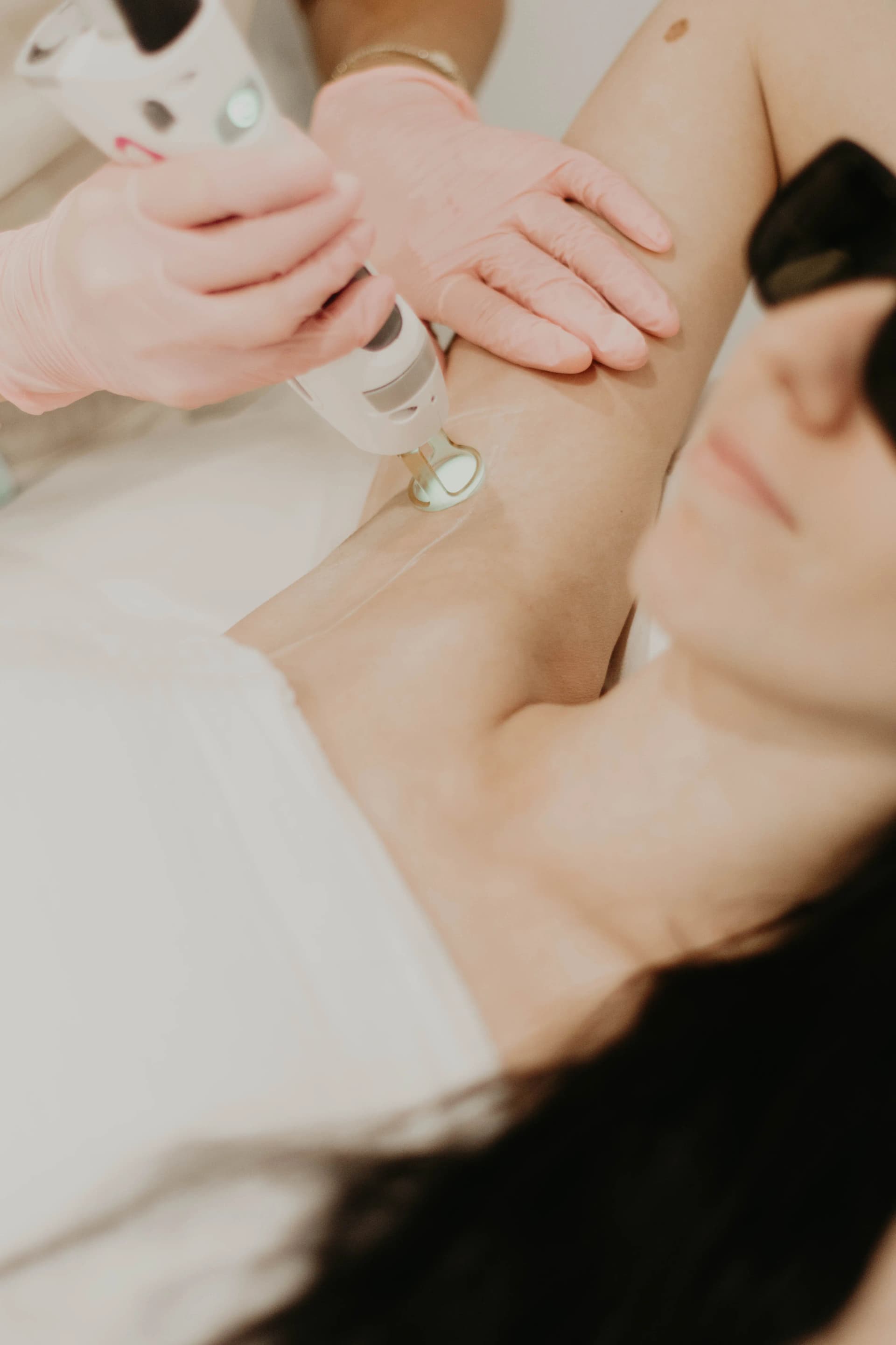 Épilation laser GentleMax Pro Plus