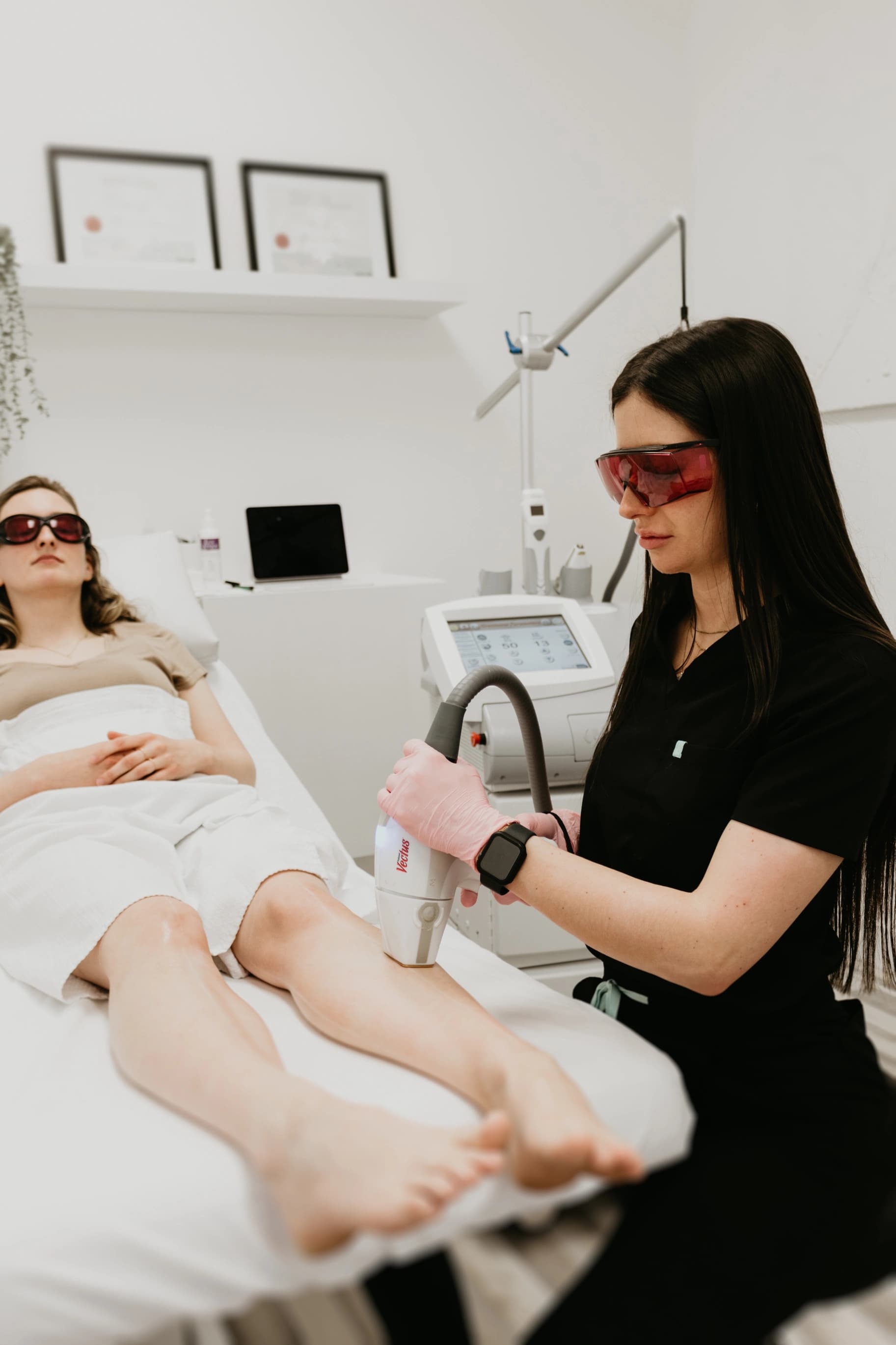 Séance d'épilation laser