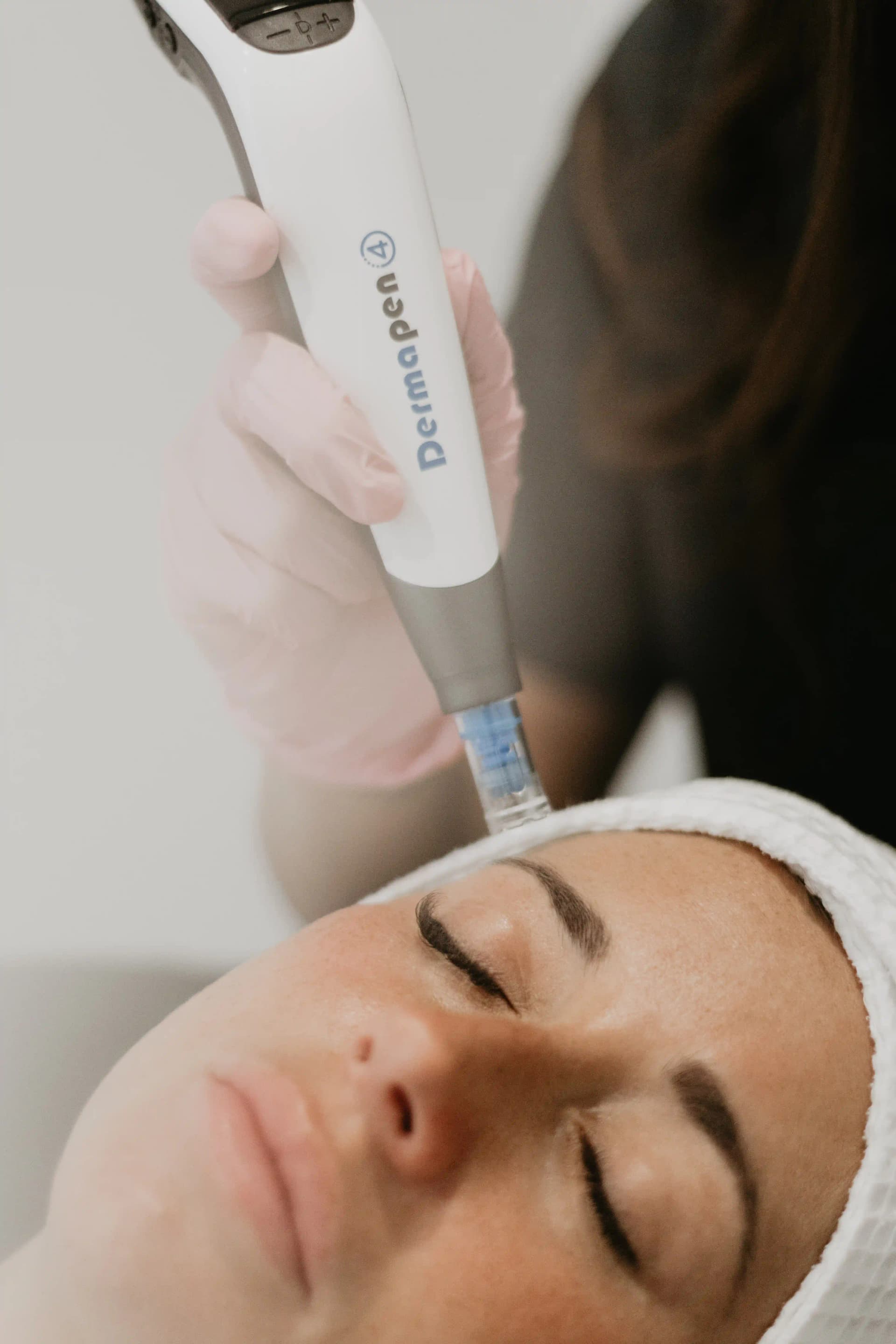 Séance de microneedling DP4